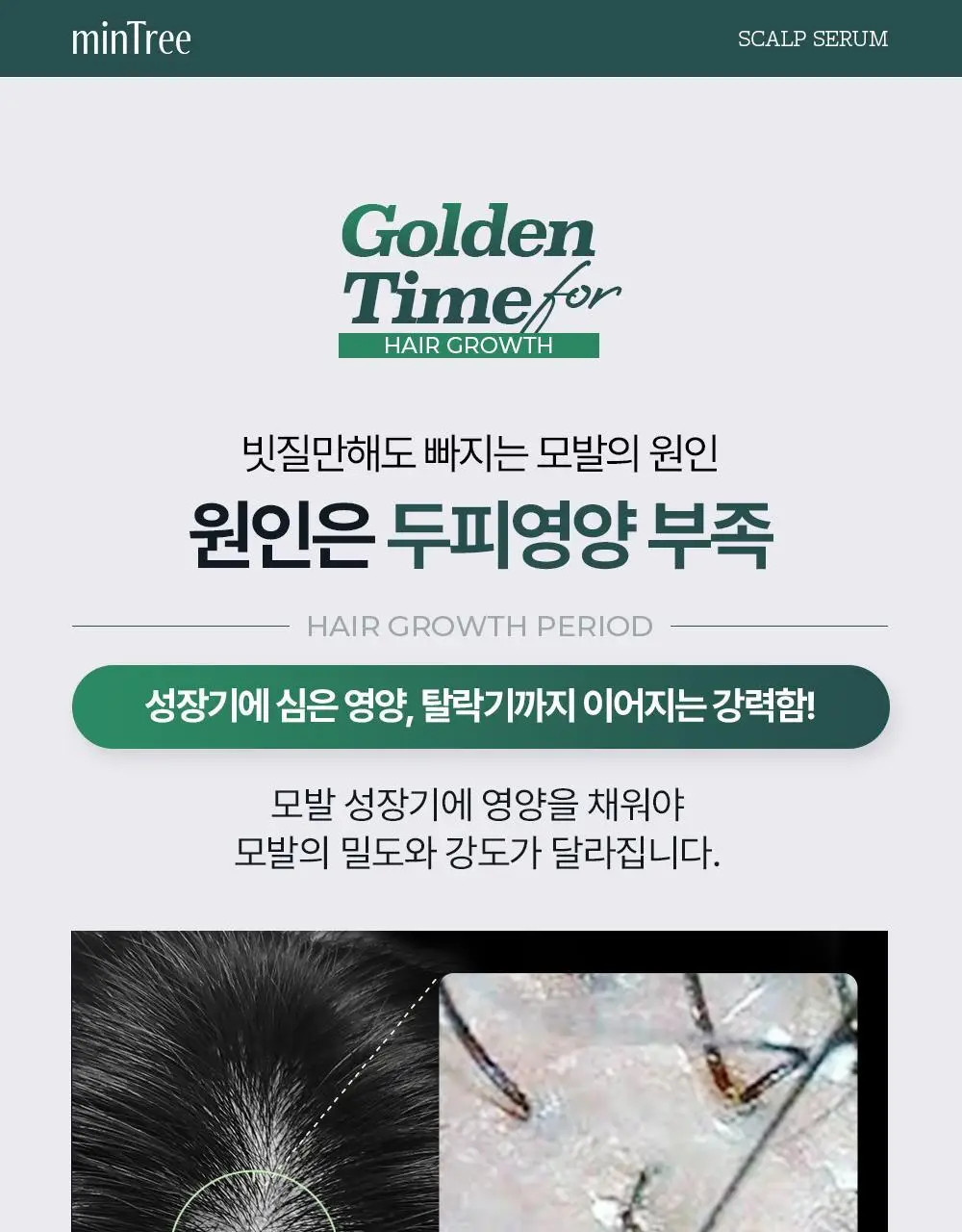 [올영1위 두피앰플] 민트리 스칼프 세럼 20ml 상세페이지 3